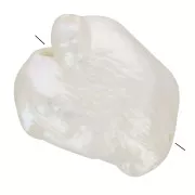 Irregular Keshi baroque freshwater pearl - 10 to 14 mm - AAA Grade - White x1